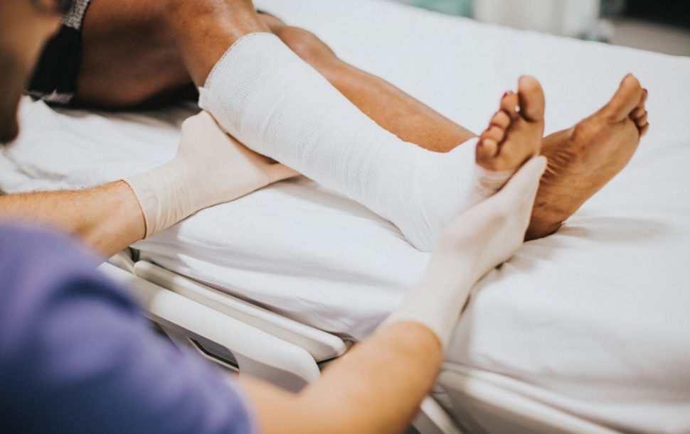 schade_gebroken_been_stockphoto